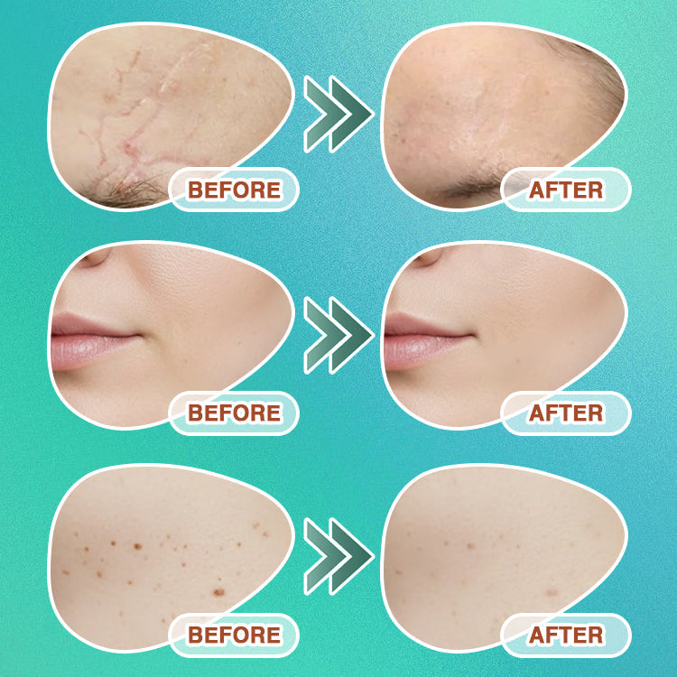 𝗖𝗮𝗿𝗲𝗕𝗿𝗲𝗲𝘇𝗲® 3-in-1 Microneedle Care Patch