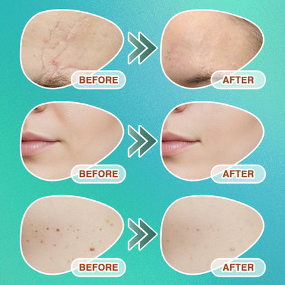 𝗖𝗮𝗿𝗲𝗕𝗿𝗲𝗲𝘇𝗲® 3-in-1 Microneedle Care Patch